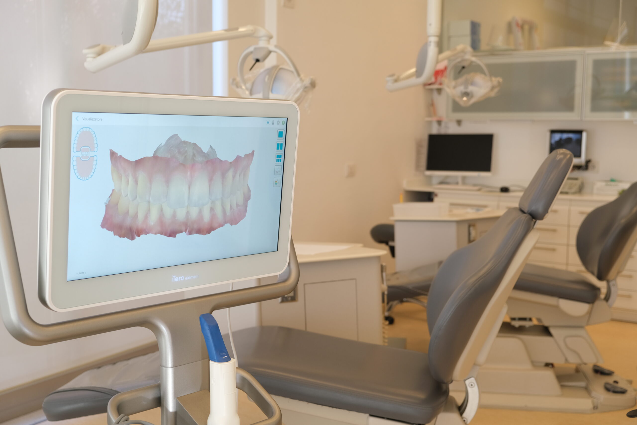 immagine dello schermo che riproduce l'impronta dentale digitale nello studio della dottoressa perona