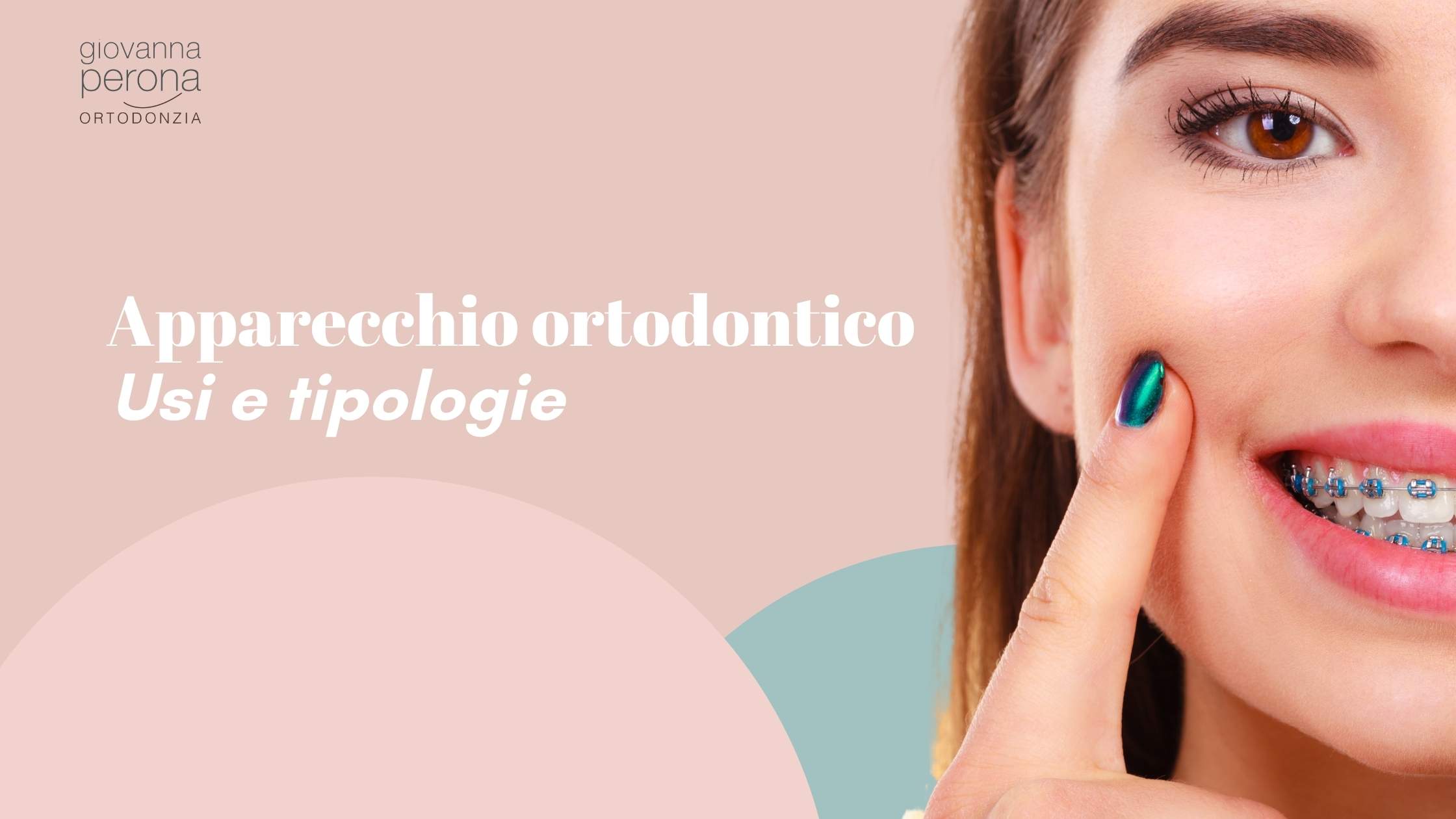 https://www.giovannaperona.it/wp-content/uploads/2023/06/Apparecchio-ortodontico-usi-e-tipologie.jpg